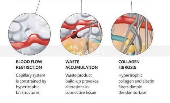 benefits of shockwave
